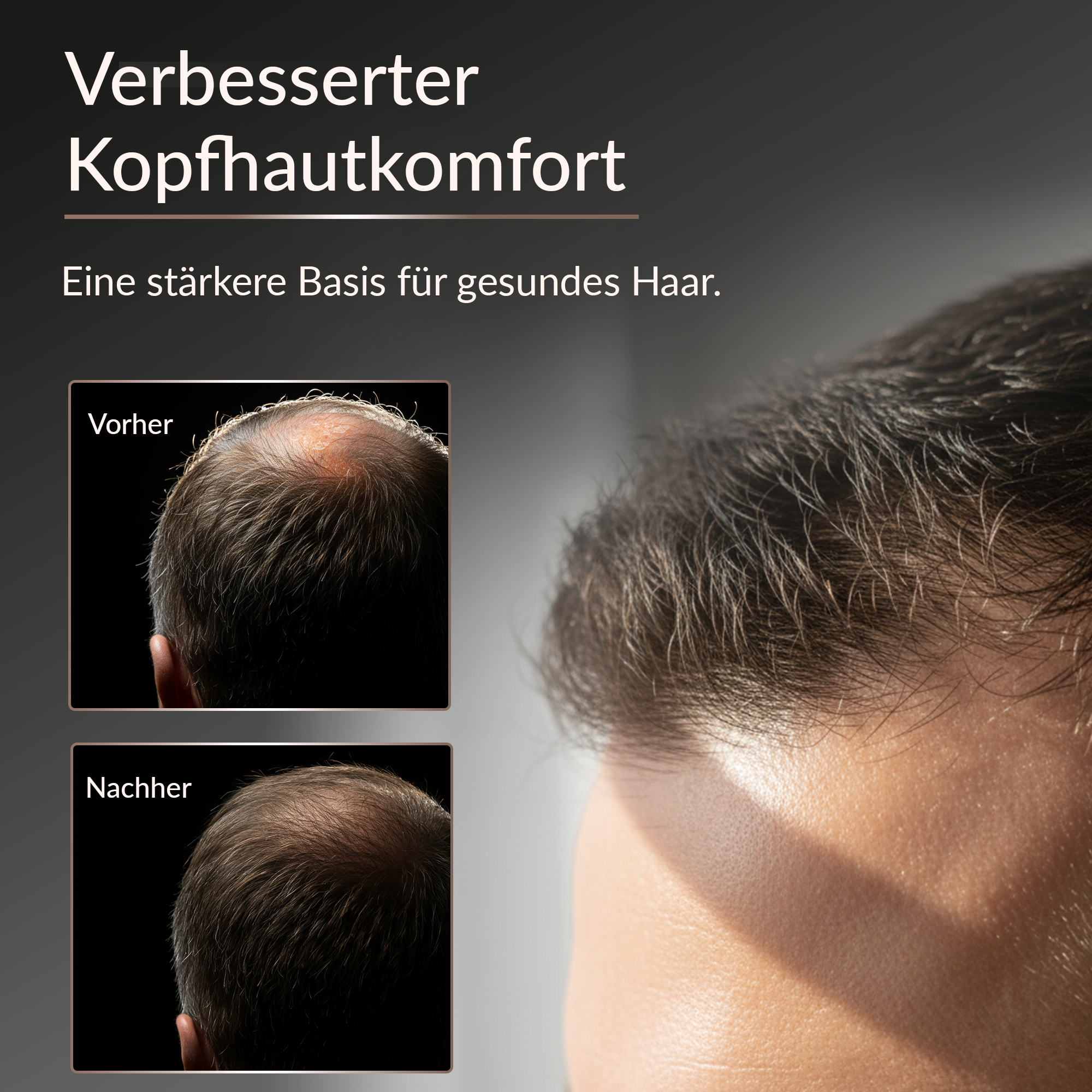 Massaggiatore per cuoio capelluto con luce rossa MIO